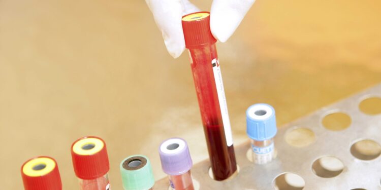 L&rsquo;albumine sanguine transforme les infections à levures en menaces potentiellement mortelles