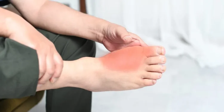 Des chercheurs ressuscitent un gène vieux de vingt millions d&rsquo;années contre la goutte