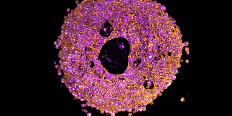 Des mini-placentas imprimés en 3D marquent une première mondiale révolutionnaire